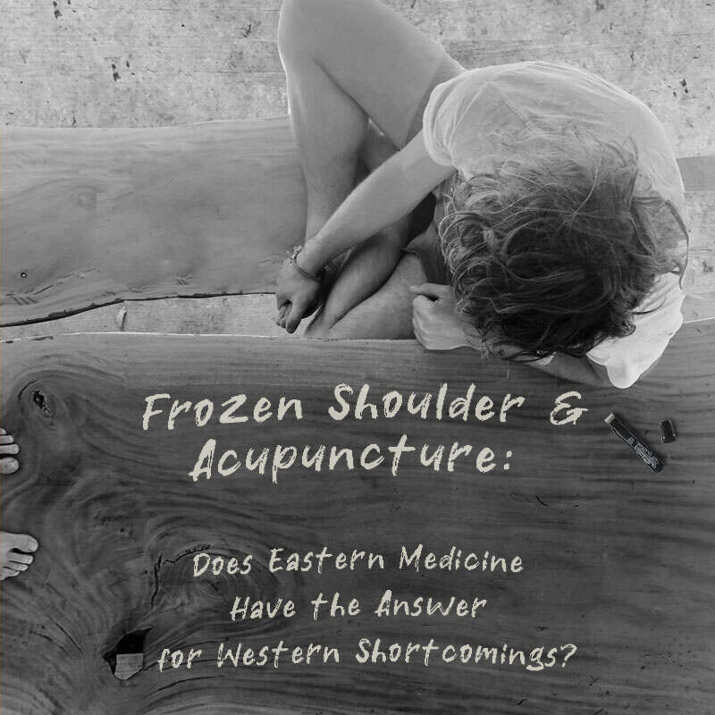 Frozen Shoulder and Acupuncture